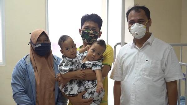 Bayi Kembar Siam Kembali Laksanakan Operasi Lanjutan