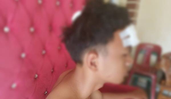 Remaja  15 Tahun di Tembung Jadi Korban Penganiayaan