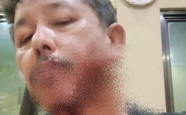 Penjaga Malam di Medan Selayang Berlumuran Darah Ditembak Air Gun, Polisi Lakukan Penyelidikan