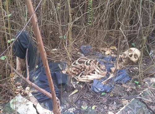 Kerangka Manusia di Jalan Letda Sujono Hebohkan Warga Tembung