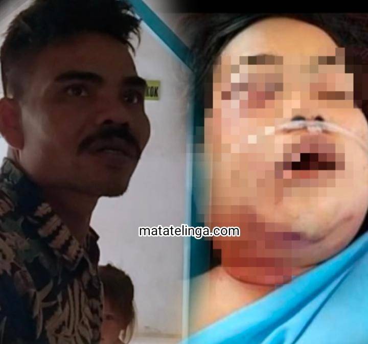Ditemukan Tergeletak Dalam Parit, Mirawati Hingga Kini Belum Sadarkan Diri