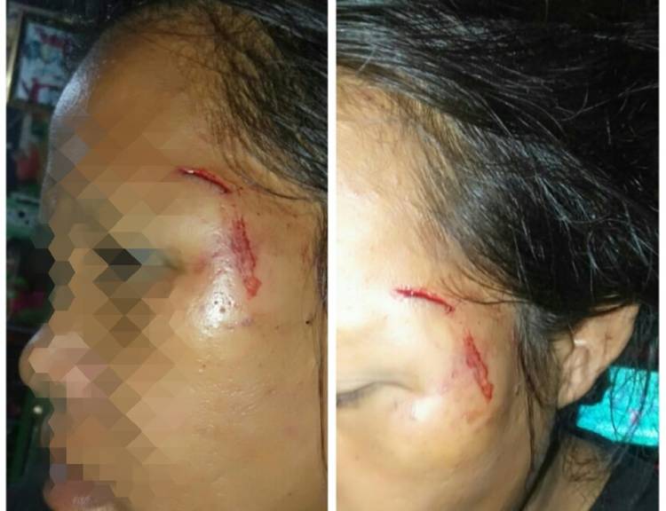 Kapolsek Panai Hilir Diduga Aniaya Wanita Penderita ODGJ, Kasusnya Diproses Div Propam Polri