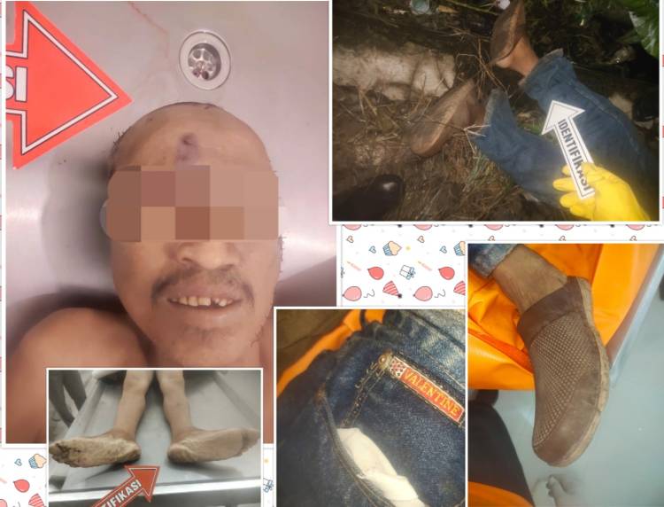 Polres Tebingtinggi Selidiki Penemuan Mayat Mr. X Akibat Terlindas Kereta Api