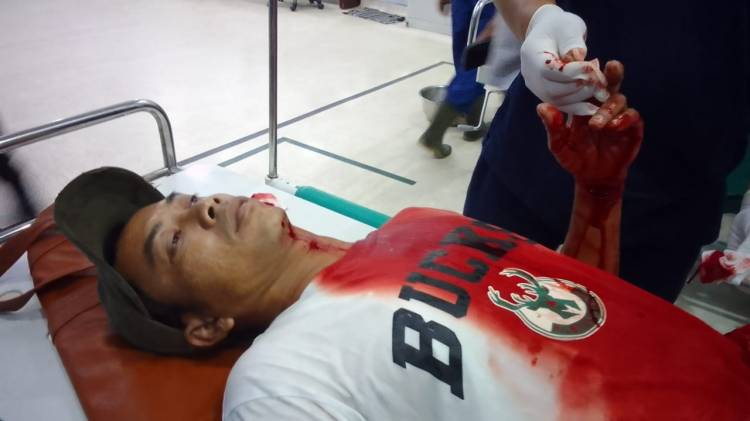 Sadis!!! Pulang Jual Kepiting, Leher Dibacok Begal, Motor dan HP Raib