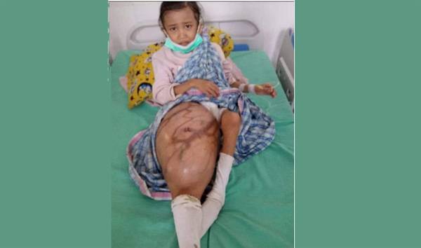 Arliza Hutapea Butuh Uluran Tangan Dermawan