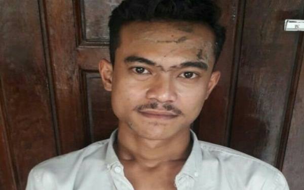 Dirkrimum Poldasu: Kasus Pemukulan Aktivis di Langkat Proses Penyidikan