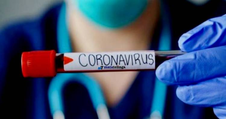 Laju Kasus Positif Covid 19 Terus Meningkat, Kepatuhan Warga Masyarakat Akan Prokes Cenderung Menurun