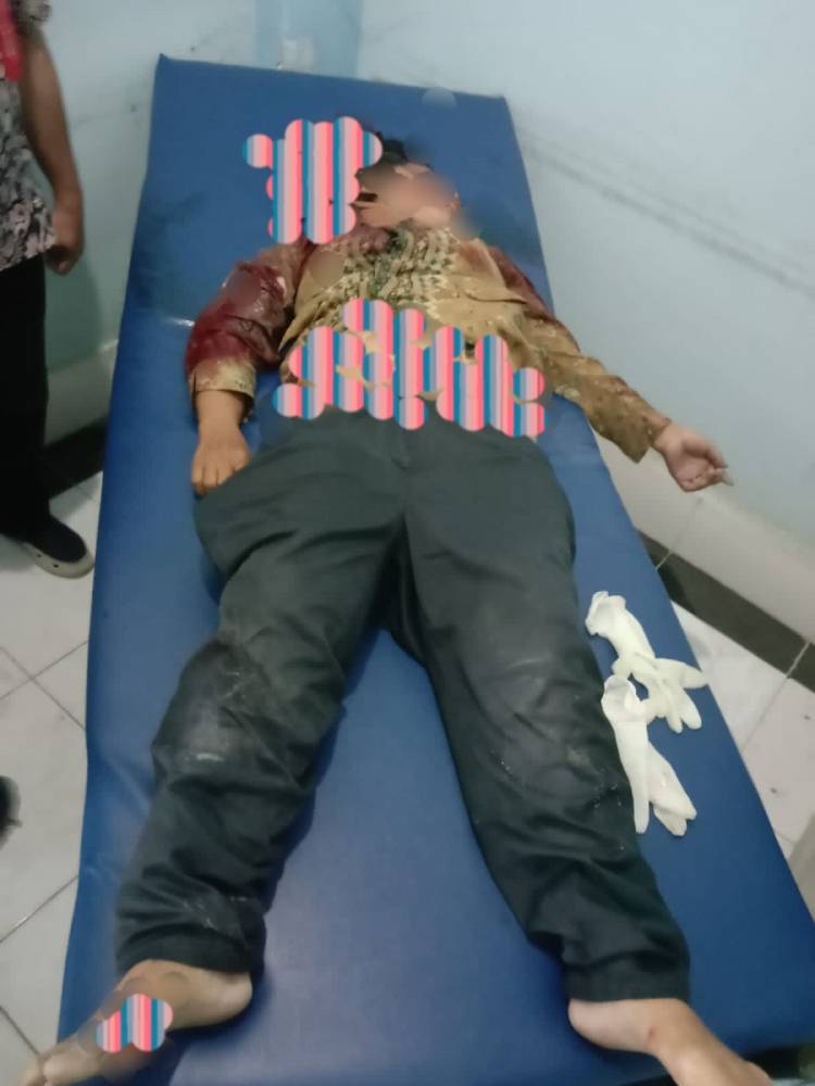 Guru Sekolah Dasar Tewas di Lindas Dump Truk