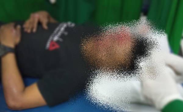 Genk Motor Aniaya 2 Ojol di Lapangan Merdeka
