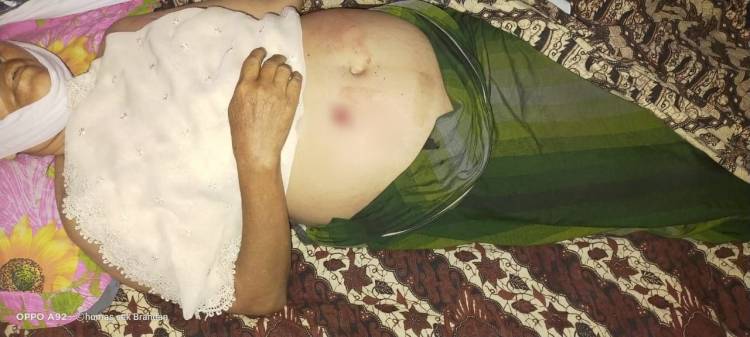 Ditemukan Tewas Bersimbah Darah, Wanita 62 Diduga Korban Pencurian Dengan Kekerasan