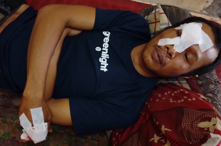 SADIS!!! Amridjal Dibacok Gerombolan di Depan Rumah