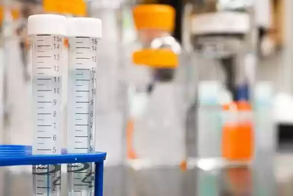 Corona Virus Masih Beraksi, Muncul Lagi Hantavirus