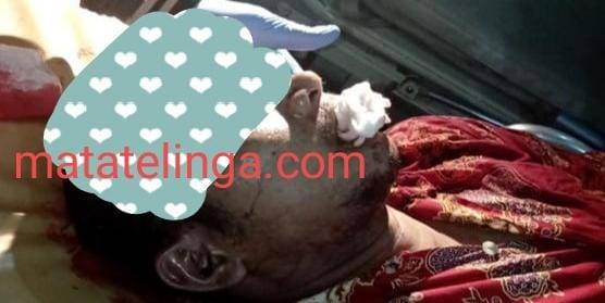 Warga Medan Labuhan Jadi Korban Penembakan Orang Tak Dikenal ( OTK )