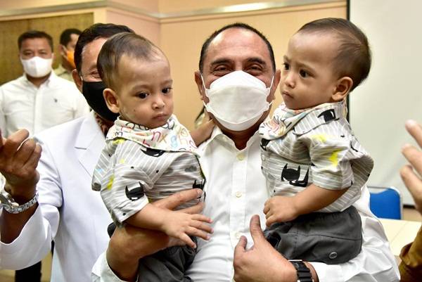 Gubernur Edy Rahmayadi Apresiasi Tim Dokter Pemisahan Kembar Siam Adam dan Haris
