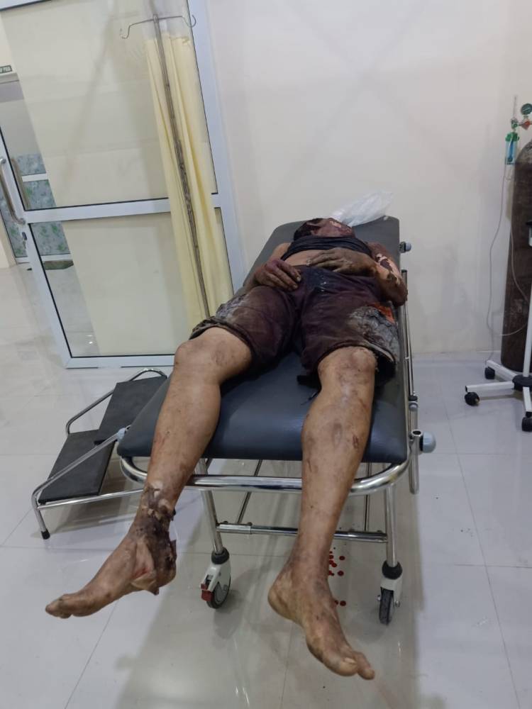 Diduga Sering Mabuk dan Buat Onar, Ngertiken Sembiring Tewas Dibakar Massa di Langkat
