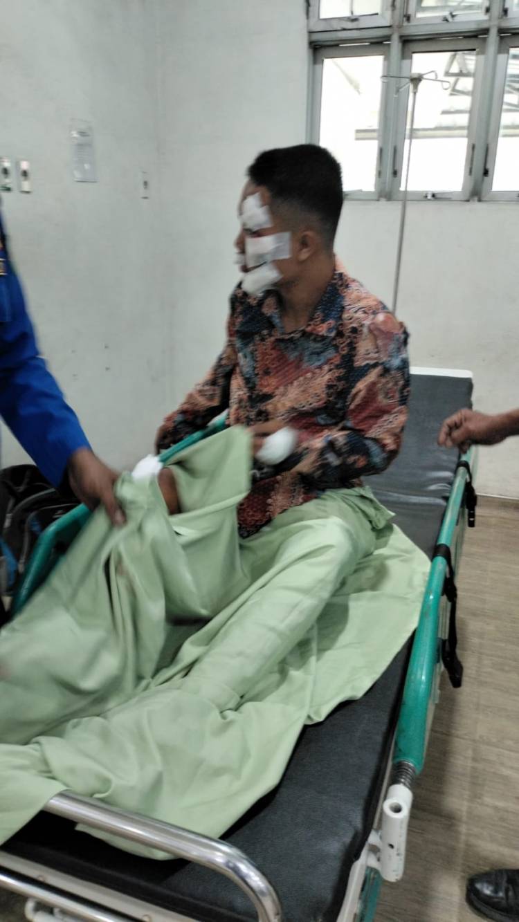 Tembung Rawan Begal, Casis Bintara Polri Jadi Korban