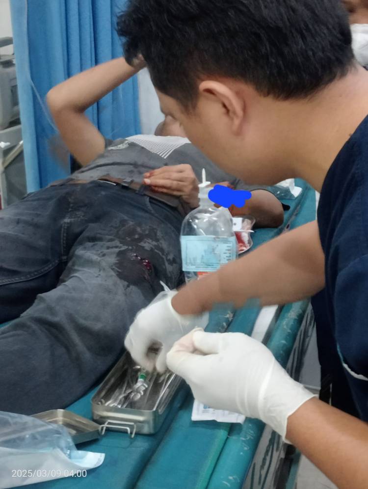 Memisahkan Dua Kelompok Pemuda Bentrok, Malah Kena Bacok