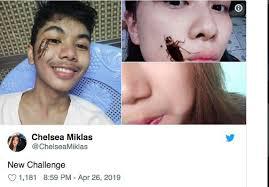 Lagi Viral Nih, Challenge Selfie Bareng Kecoa Nempel di Wajah