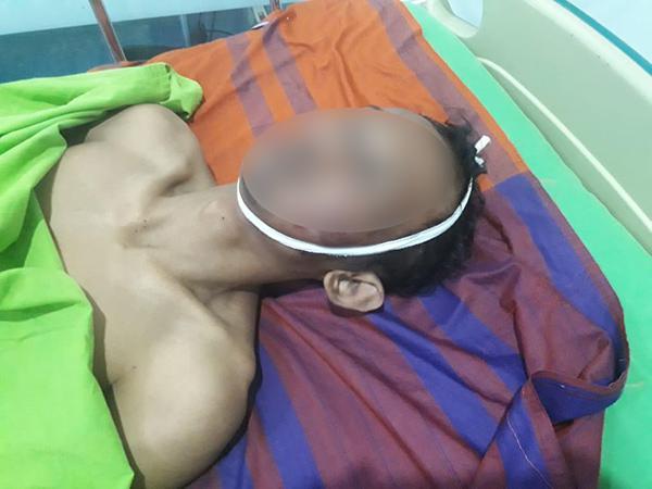 Akibat Tangan Gatal Pegang Payudara, Nyawa Melayang