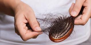 Kamu Sering Alami Rambut Rontok, Begini Cara Mengatasinya!