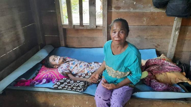 Yayasan Burangir Bantu Anak Penderita Menigitis Dari Keluarga Tidak Mampu