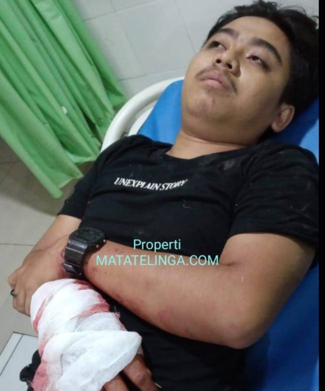 Pemuda 22 Tahun Nyaris Tewas Dibacok Genk Motor, Tangan dan Kaki Nyaris Putus