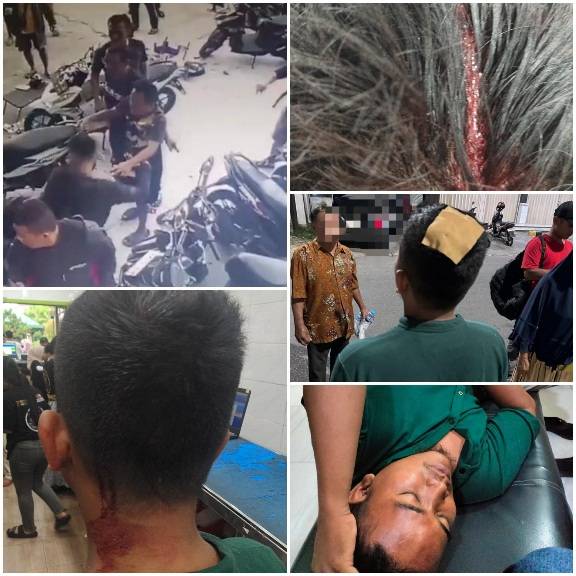 Preman Merajalela! Konsumen GMT Skip Dianiaya dan Dirampok Saat Berbelanja Sparepart Hp