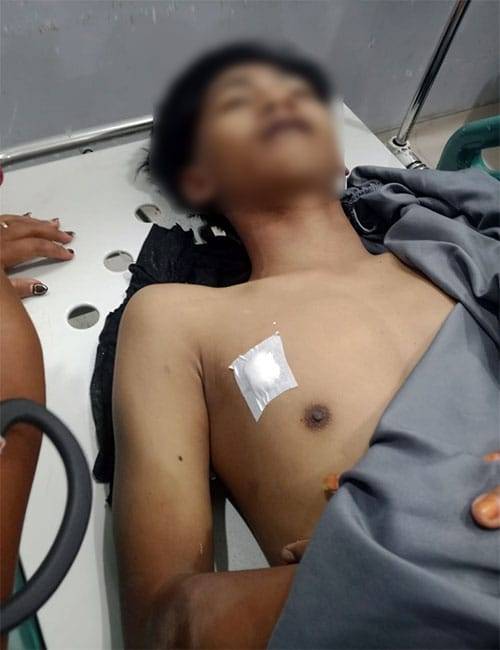 Bentrokan Antar Lorong di Belawan, RemajaTewas Ditembak Senapan Angin