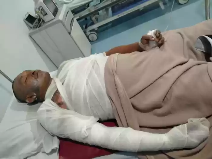 Ahmad Nyaris Tewas Dibakar Teman, Gara - Gara Laraikan Pertengkaran
