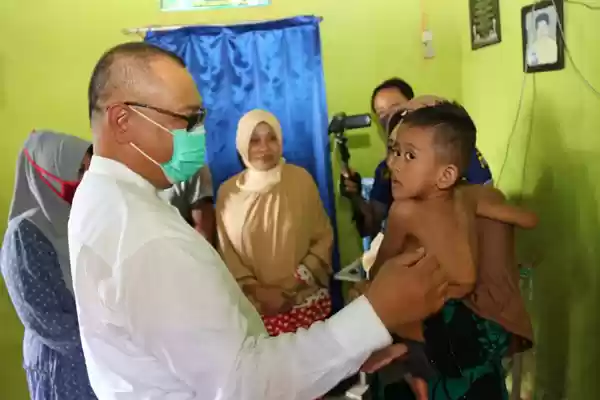 Akhyar Berkaca-kaca Melihat Kondisi Anak Penderita Kelainan Fisik