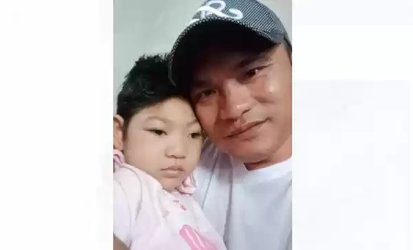 Uli Br Pane Bocah 3 Tahun Butuh Uluran Tangan Dermawan Untuk Berobat