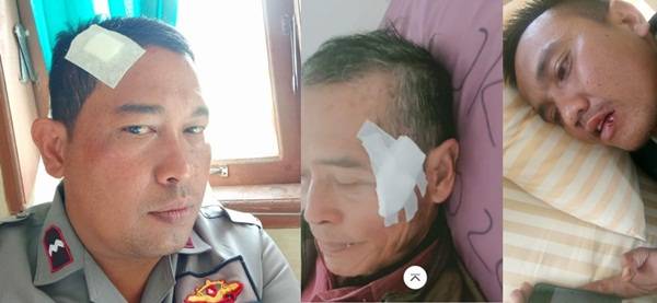 Banyak Korban Luka, Aksi Berujung Bentrok Warga Natumingka dengan PT. TPL Tuai Kontroversi