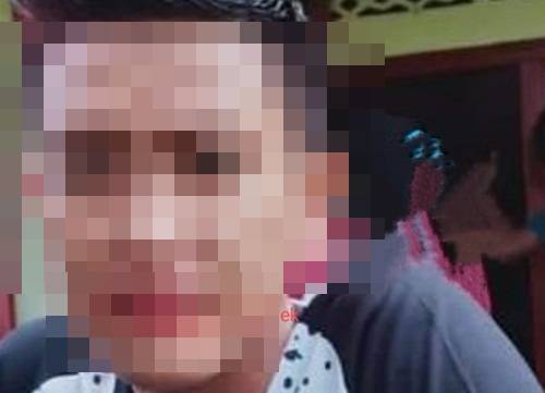 Lima Bulan Berlalu, Pelaku Penyiraman Air Keras Terhadap Fery Tak Kunjung Ditangkap