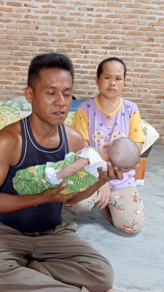 Di Sergai, Bayi Penderita Penyakit Membutuhkan Bantuan Dermawan