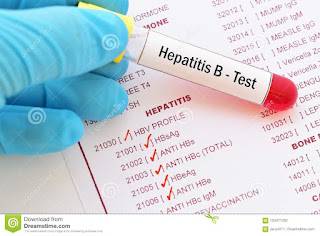 RS Siap Tangani Kasus Hepatitis Akut Misterius, Meski Belum di Temukan