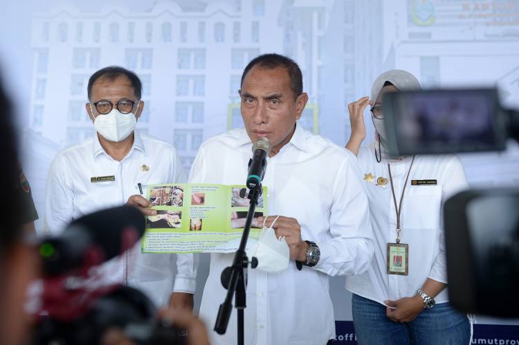 Pengendalian Wabah PMK di Sumut, Gubernur Edy Lakukan Tiga Langkah Ini