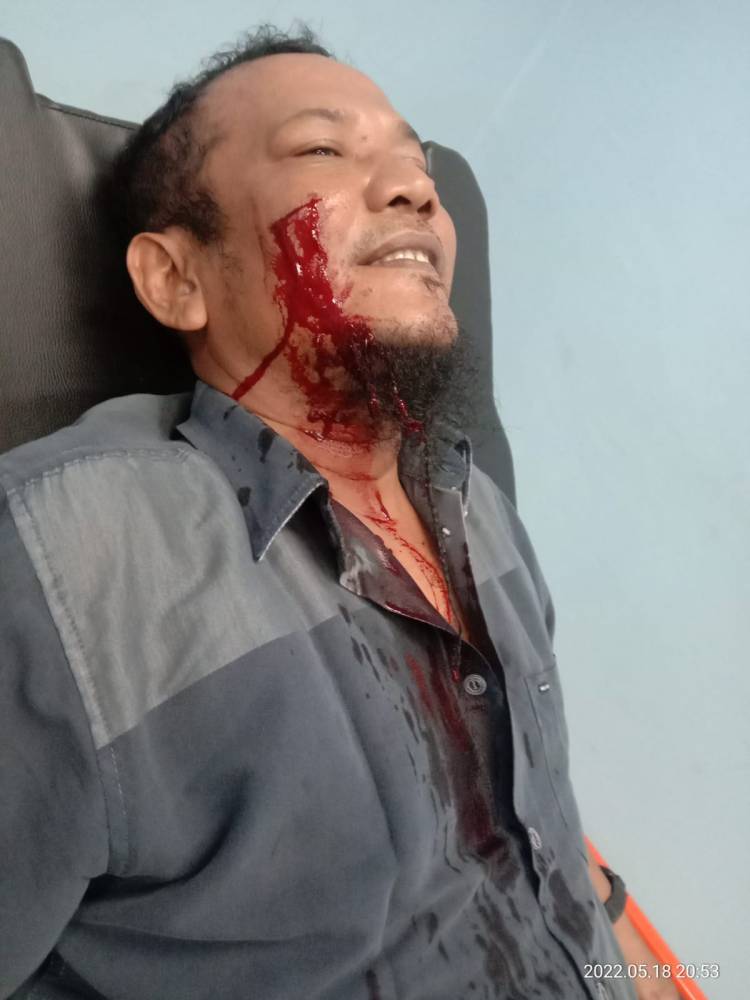 Ketua PWI Sumatera Utara Desak Polres  Tapteng Tangkap Pelaku Pembacokan Wartawan