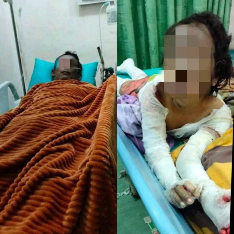 Tragedi Kebakaran Rumah Akibat Tabung Meledak Setelah Istri, Menyusul Suami Dan Anak Meninggal Dunia