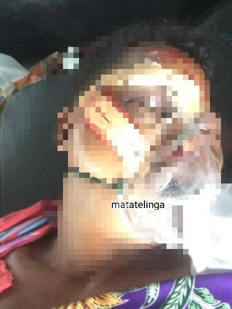 Dua Hari Setelah Kejadian Keluarga Korban Laka Lantas Baru Buat Pengaduan