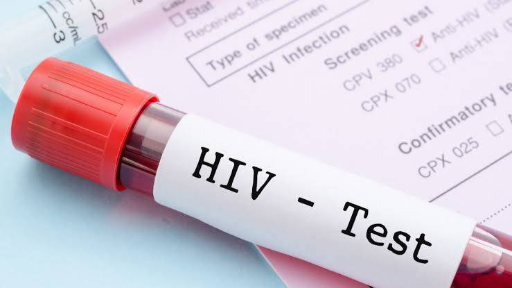 Pasien HIV/AIDS Meningkat di RSU Pirngadi Medan