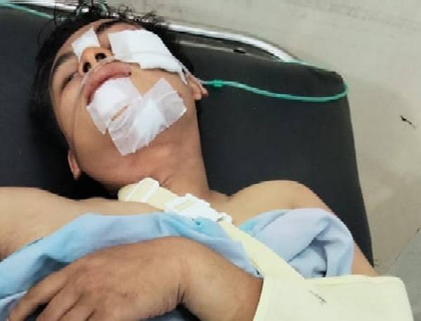 Septor &lsquo;Laga Kambing&rsquo; Vs Mobil L300, 1 Tewas dan 2 Luka &ndash; luka