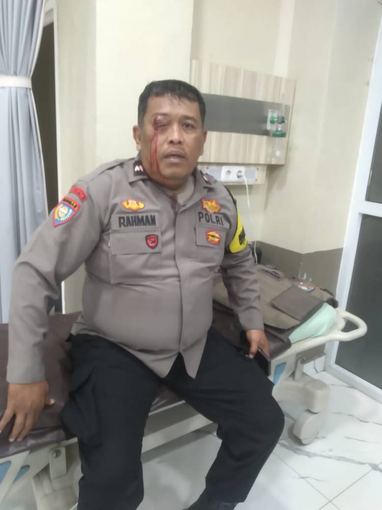 Personel Polsek Medan Labuhan Buta Pasca Dilempar Pelaku Tawuran