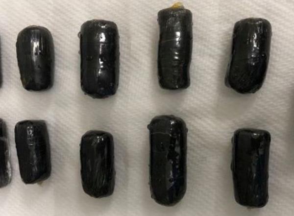 Pria Asal Malaysia Tertangkap Bawa 16 Heroin dan di Keluarkan dari Duburnya