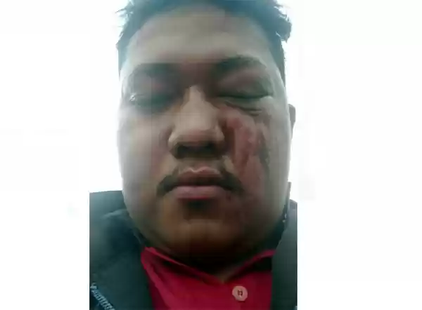 Wartawan Mimbar Umum Dianiaya Di Kawasan Delitua