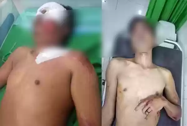 Dua Perampok Berujung ke Rumah Sakit Bhayangkara Medan