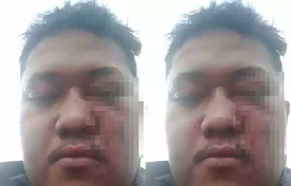 LBH Medan Minta Polisi Usut Sampai Tuntas Penganiayaan Jurnalis di Delitua
