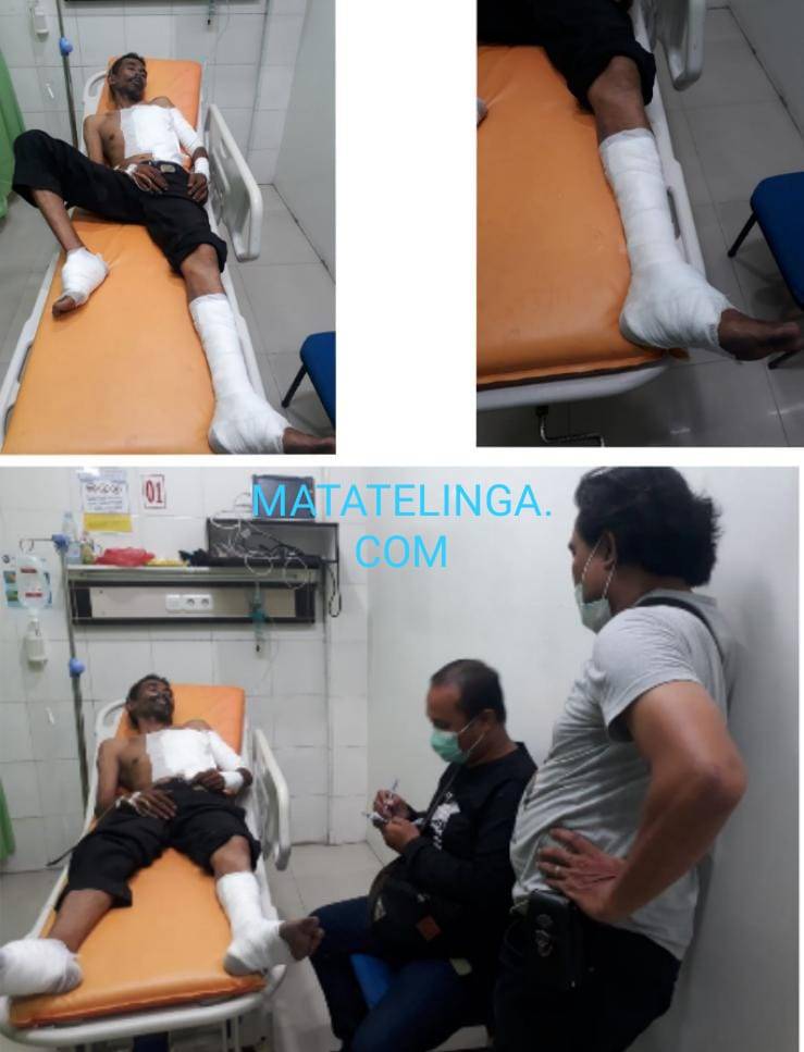 Niat Mengganti Lampu Penerangan Jalan, Edi Sutrisno Nyaris Tewas Kesetrum