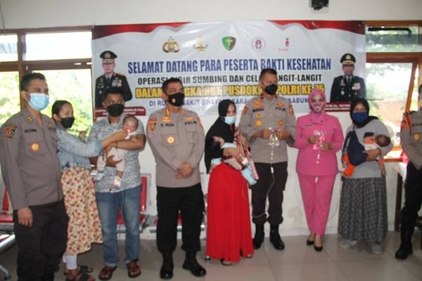 Setukpa Lemdiklat Polri Gelar Operasi Bibir Sumbing Gratis untuk Anak-anak