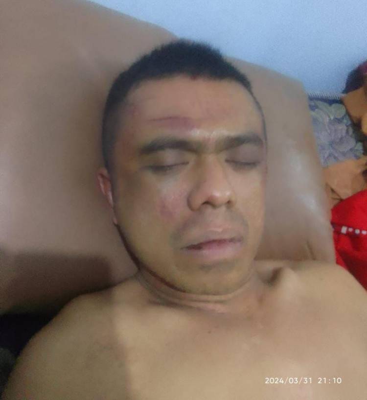 Pelaku Penganiayaan Sadis di Sibolangit Masih Berkeliaran, Pengamat Hukum : Pelaku Keburu Melarikan Diri