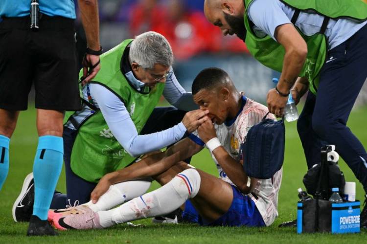 Menang ya Menang, Tetapi Cedera Patah Tulang Hidung Dialami Mbappe